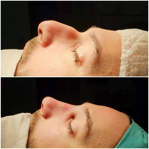 Before after photos of our patients 5